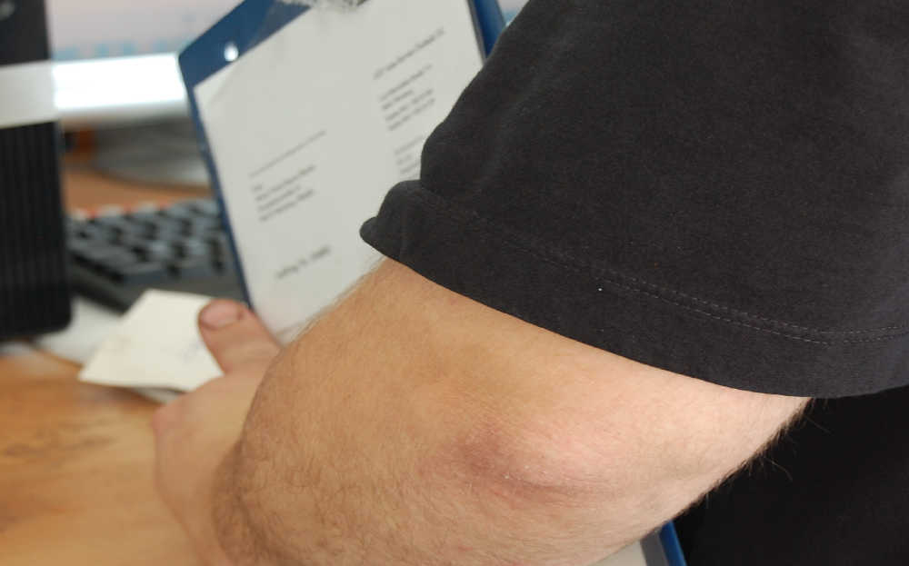 Kundendienst bei AST